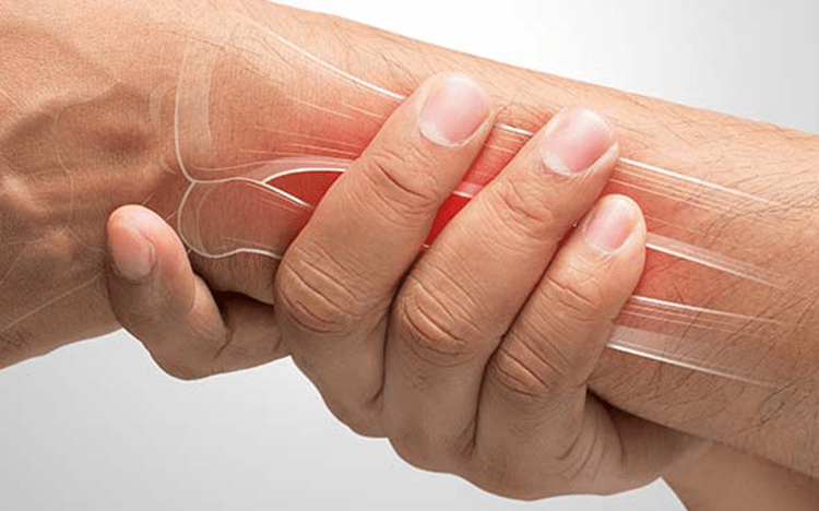 Tendinitis